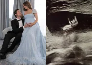 Barbara Palvin dan Dylan Sprouse Umumkan Kehamilan Anak Pertama