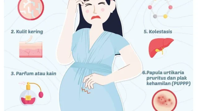 Mengatasi Gatal Saat Hamil: Solusi Aman dan Tanpa Obat untuk Ibu dan Janin