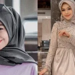 Ria Ricis Jalani Operasi Hidung untuk Mengatasi Kondisi Medis