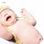 Pusar Bayi Menonjol? Ini Penyebabnya yang Mungkin Anda Tidak Sadari